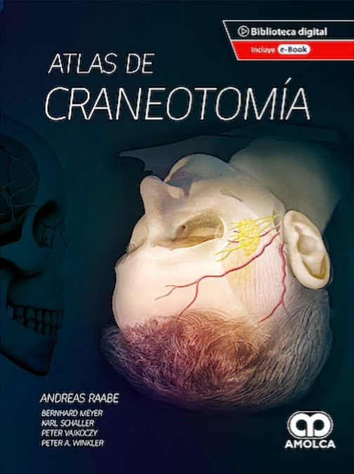 Atlas de Craneotomia